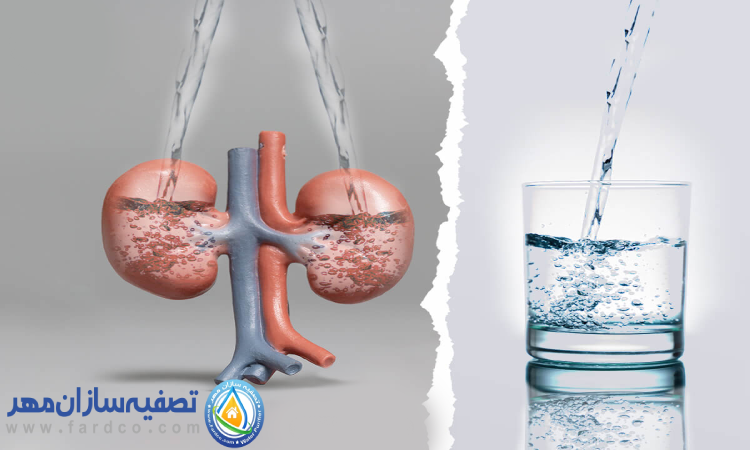 تصفیه آب برای بیماران کلیوی و دیابتی